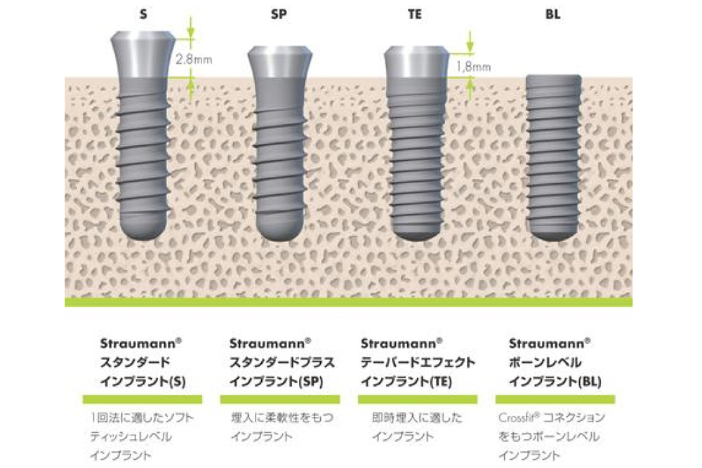 マウスピース矯正