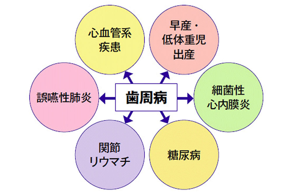 歯周病と全身疾患