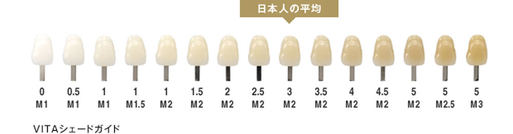 黒ずんだ歯のホワイトニング